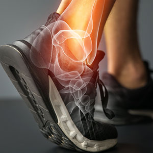 Foot and ankle pain